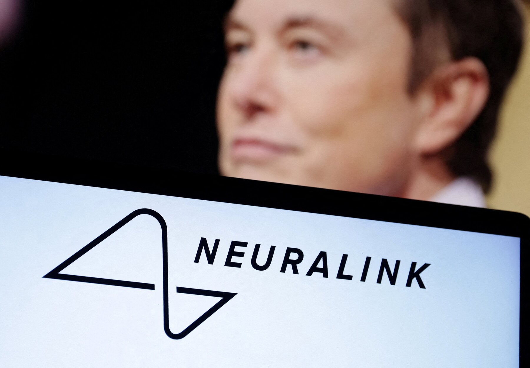 Neuralink від Маска створив перший імплантат людського мозку